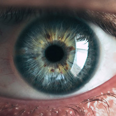 Irisdiagnostik